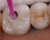 //iirorwxhloqjli5p.ldycdn.com/cloud/liBpkKloljSRilliqrlrjo/implant-abutment-screw-dimensions.jpg