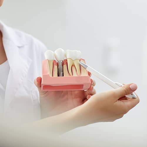 How Does Preload Affect Implant Abutment Screw Stability?
