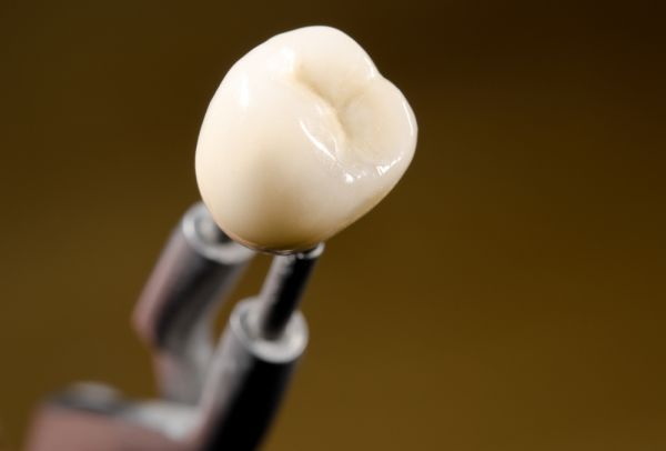 what is the best dental implant material