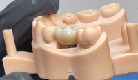 //iirorwxhloqjli5p.ldycdn.com/cloud/liBpkKloljSRrlnlljjrjo/custom-healing-abutment-fabrication.jpg