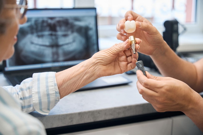 are dental implant facebook ads not allowed