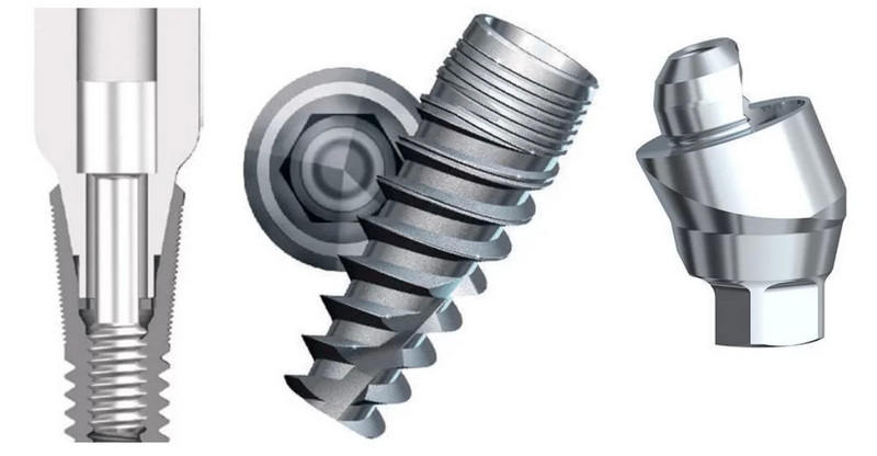 What Are The Key Features of A Dental Abutment Screw Extractor Patent?