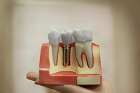 //iirorwxhloqjli5p.ldycdn.com/cloud/liBpkKloljSRrlqkopnpjp/my-abutment-screw-fell-out.jpg