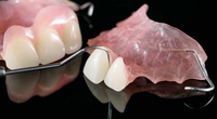//iirorwxhloqjli5p.ldycdn.com/cloud/liBpkKloljSRrlqllljojq/can-you-have-a-dental-implant-at-any-time.jpg