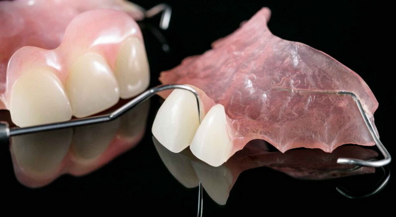 Can You Have A Dental Implant at Any Time?