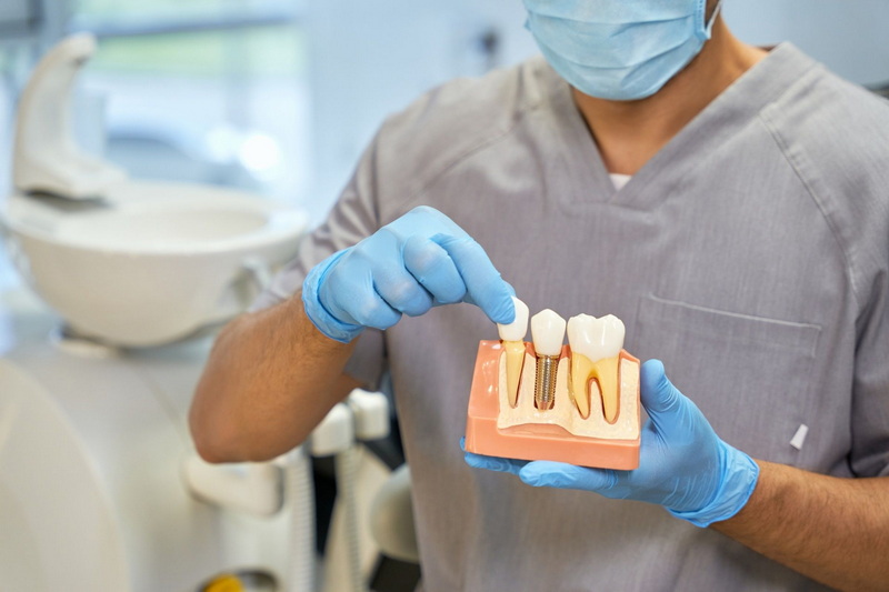 can dental implant be covered under medical insuresan