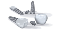 //iirorwxhloqjli5p.ldycdn.com/cloud/ljBpkKloljSRilmrlimljq/typical-cost-for-dental-abutment-and-zirconia-crown.jpg