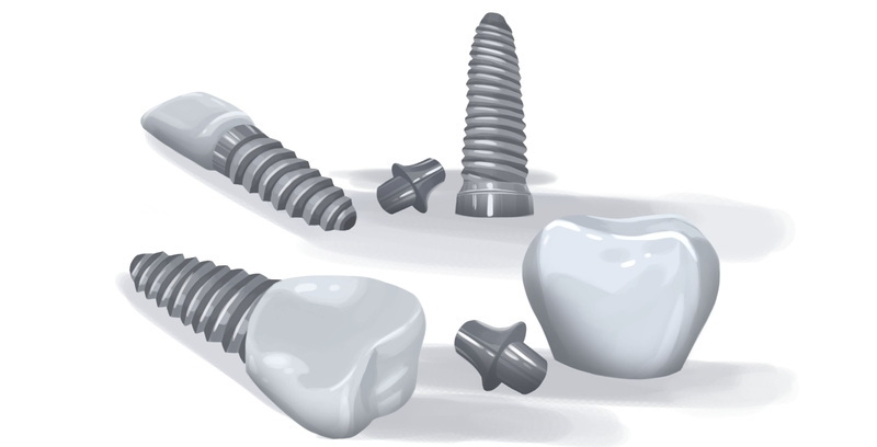 typical cost for dental abutment and zirconia crown