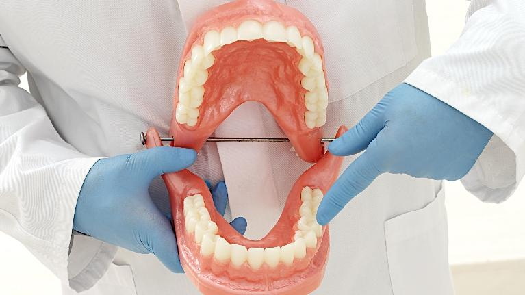 you need anesthesia for dental implant_1