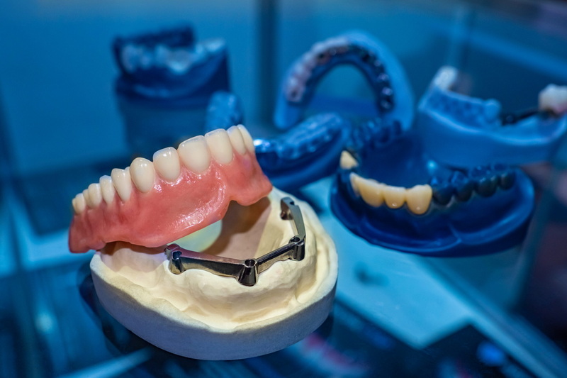 dental implant_3