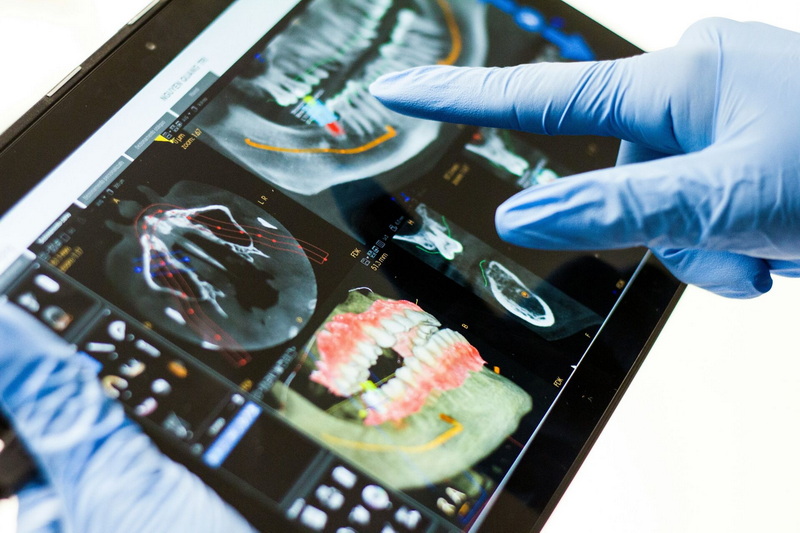 the signs of a failing dental implant_1