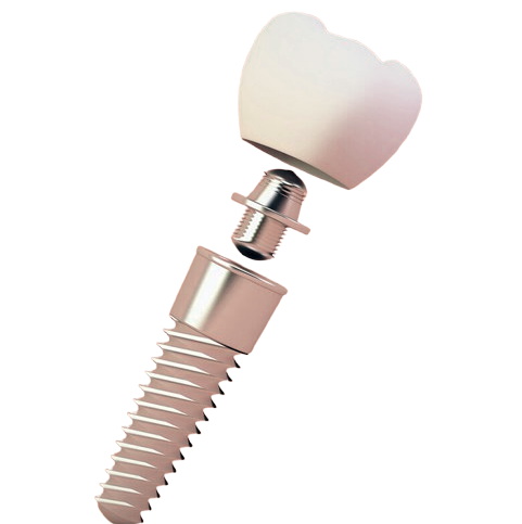 do gums grow over dental implant after two months