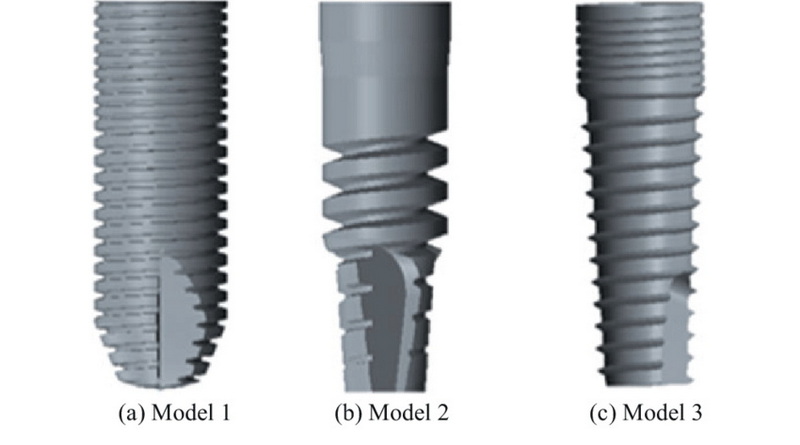 What Happens If You Over-Torque A BioHorizons Abutment Screw?