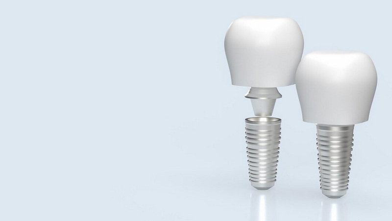 dental abutment loose