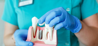 //iirorwxhloqjli5p.ldycdn.com/cloud/ljBpkKloljSRrlrnjrlqjo/can-you-place-a-dental-implant-on-infected-area.jpg