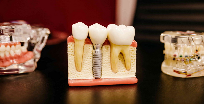 Where Can I Find The Official Omnilock Abutment Screw Torque Guide?