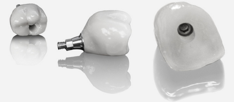 healing abutment neodent