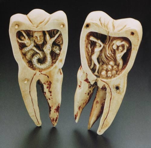 What Not To Do After A Dental Implant?