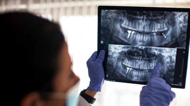 Is Throbbing Pain Normal After Dental Implant?
