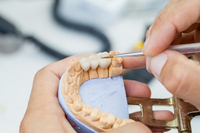 //iirorwxhloqjli5p.ldycdn.com/cloud/lkBpkKloljSRrllpopnpjp/my-dental-abutment-fell-out.jpg
