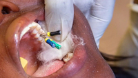//iirorwxhloqjli5p.ldycdn.com/cloud/lkBpkKloljSRrlqlpnkjjq/abutment-screw-design.jpg