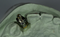 //iirorwxhloqjli5p.ldycdn.com/cloud/llBpkKloljSRillikjnljo/keystone-final-abutment-screw.jpg