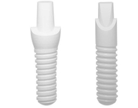 //iirorwxhloqjli5p.ldycdn.com/cloud/llBpkKloljSRilnimrlrjo/do-you-have-to-be-sedated-for-a-dental-implant.jpg