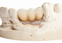 //iirorwxhloqjli5p.ldycdn.com/cloud/llBpkKloljSRilrkmlqojq/stainless-steel-implant-abutment-screw.jpg