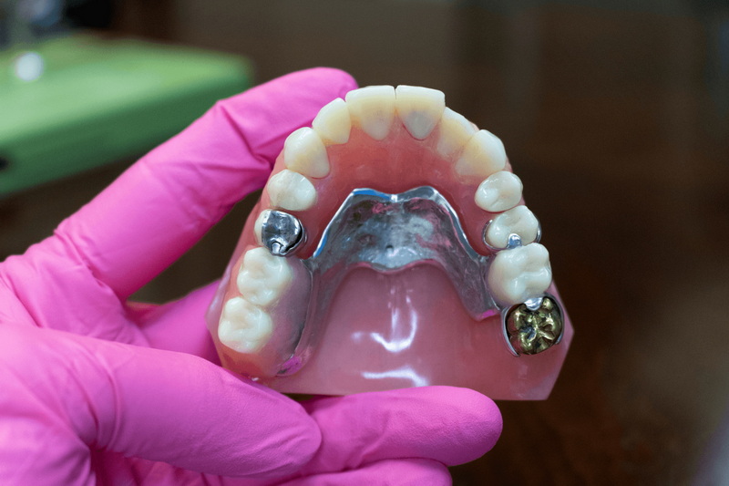 when can wear my flipper after dental implant_2