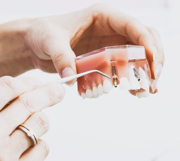 the procedure for a dental implant_3