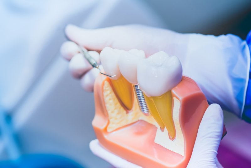 What Are The Signs of Dental Implant Infection?