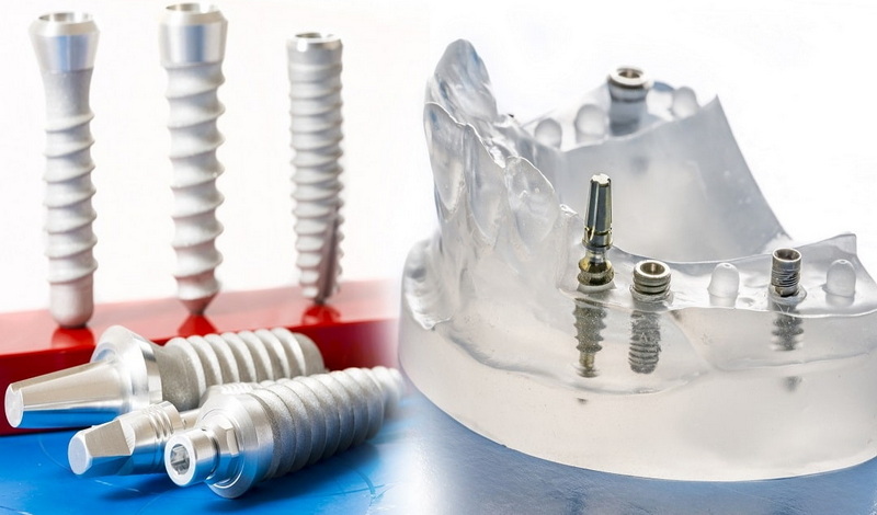 How Long To Heal From Dental Implant?