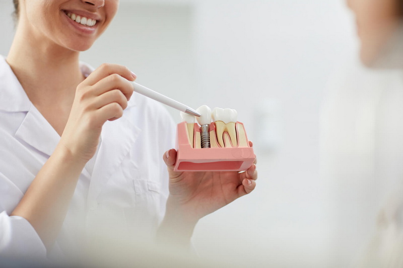 how long after dental implant surgery can i exercise_24