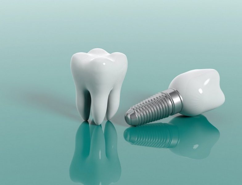 When Can You Eat Solid Food After Dental Implant?