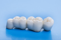 //iirorwxhloqjli5p.ldycdn.com/cloud/lmBpkKloljSRrlmlllmnjq/dental-implant-healing-abutment-loose.jpg