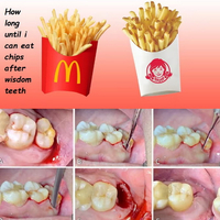 //iirorwxhloqjli5p.ldycdn.com/cloud/lmBpkKloljSRrlokiilrjn/can-you-eat-chips-after-dental-implant.jpg