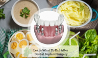 //iirorwxhloqjli5p.ldycdn.com/cloud/lmBpkKloljSRrlrllllmjo/can-you-eat-shrimp-after-dental-implant-surgery.jpg