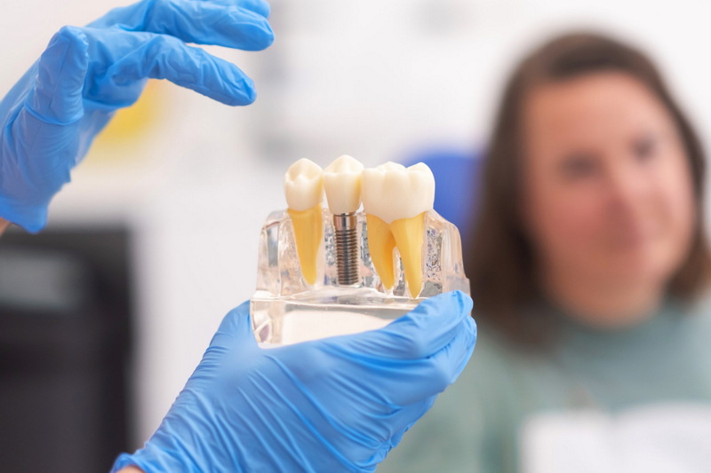 What Are The Risks Of A Loose Healing Abutment Screw?