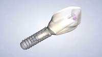 //iirorwxhloqjli5p.ldycdn.com/cloud/lnBpkKloljSRiliimiiqjo/hiossen-healing-abutment-sizes.jpg