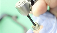 //iirorwxhloqjli5p.ldycdn.com/cloud/lnBpkKloljSRilmjonrpjq/remove-stripped-implant-abutment-screw-code.jpg