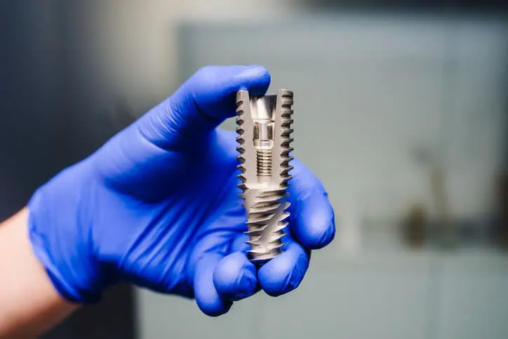 Are Nobel Abutment Screws Compatible with Other Implant Systems?