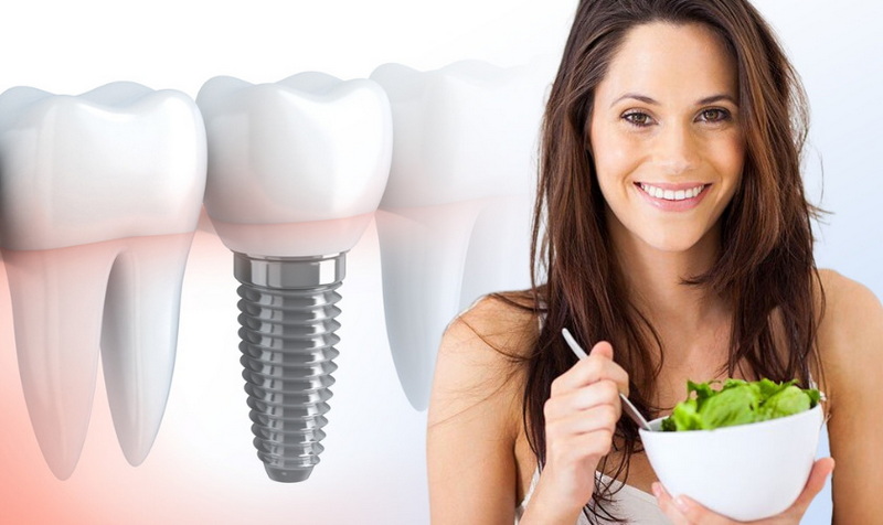how soon can you eat normally after a dental implant_3