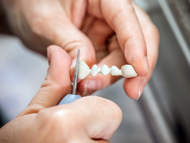 why is my dental implant sensitive_2