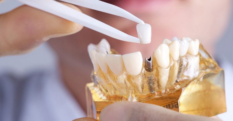 is throbbing pain normal after dental implant_2
