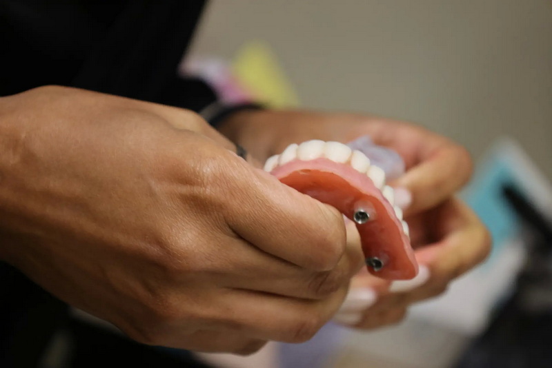 implant abutment screw