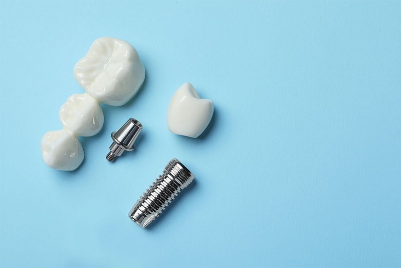 implant abutment screw loosening