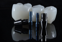 //iirorwxhloqjli5p.ldycdn.com/cloud/lnBpkKloljSRrlmlnjlqjq/delta-dental-abutment-coverage.jpg