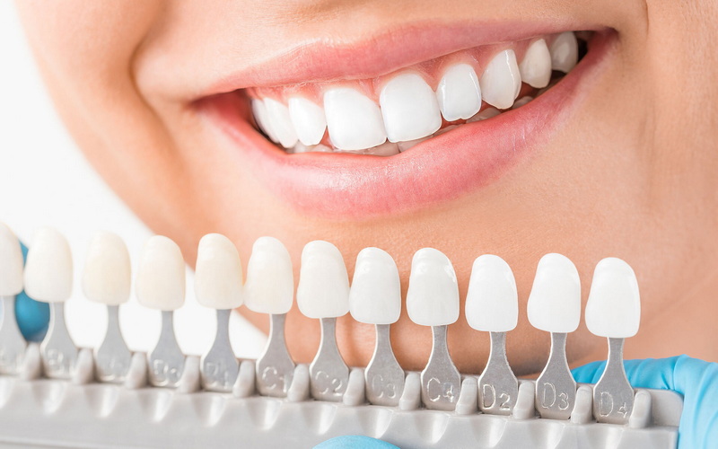 How To Take Care After Dental Implant?