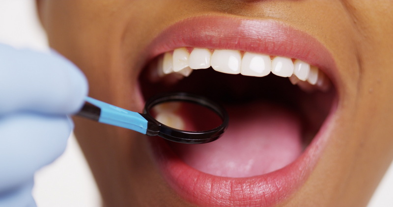 Should I Get Dental Implant?