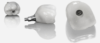//iirorwxhloqjli5p.ldycdn.com/cloud/loBpkKloljSRilnjmnrrjo/do-you-still-probe-around-a-dental-implant.jpg